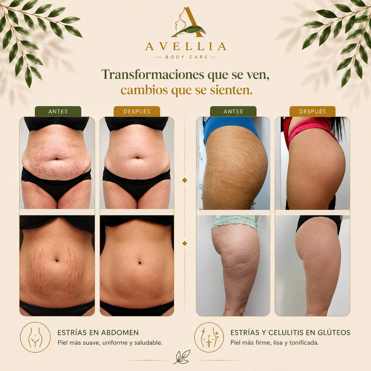 Avellia Crema Corporal Reparadora