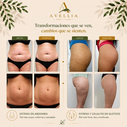 Avellia Crema Corporal Reparadora